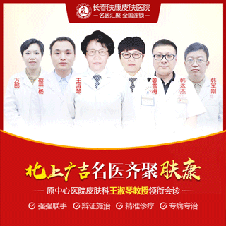 脂溢性皮炎头皮怎么治疗